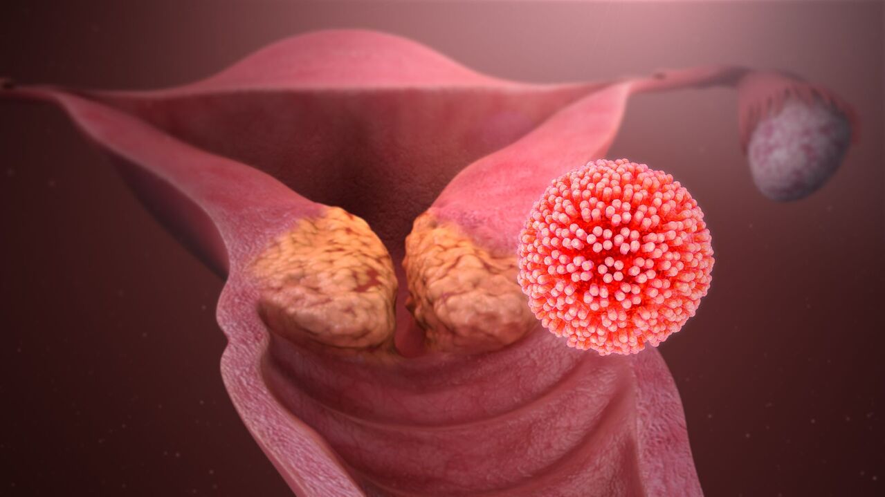ljudski papiloma virus u tijelu